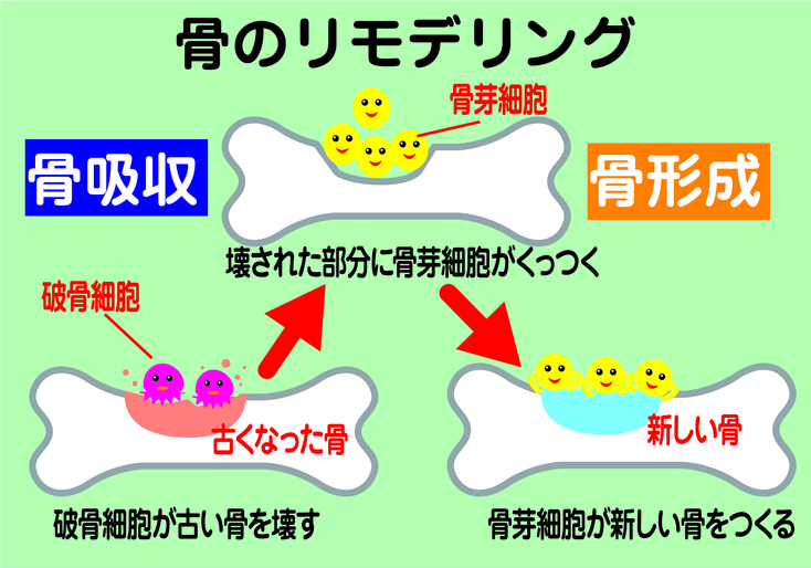 骨のリモデリングの図